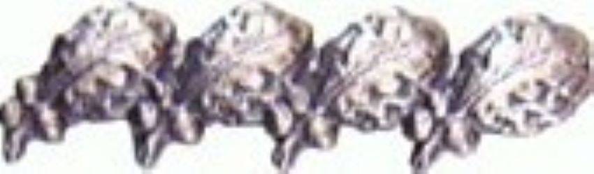 US Army Oak Leaf Cluster 5/16 Quad Silver Ribbon Device